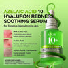 Anua Azelaic Acid 10 Hyaluron Redness Soothing Serum, 1.01 fl oz | Facial Serum for Blemish-Prone &amp; Oily-Prone Skin, Lightweight &amp; Hydrating Blemish Care, Hyaluronic Acid, Korean Skincare