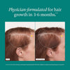 Nutrafol Women's Balance Hair Growth Supplements, Age 45+