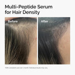 The Ordinary Multi-Peptide Serum for Hair Density, Peptide-Powered Formula for Thicker, Fuller Looking Hair