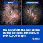 Men's Rogaine 5% Minoxidil Topical Foam, Unscented, 3 x 2.11 oz